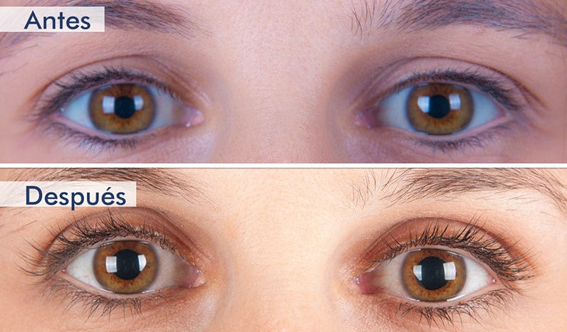 XLASH 5ML - Suero crece pestañas